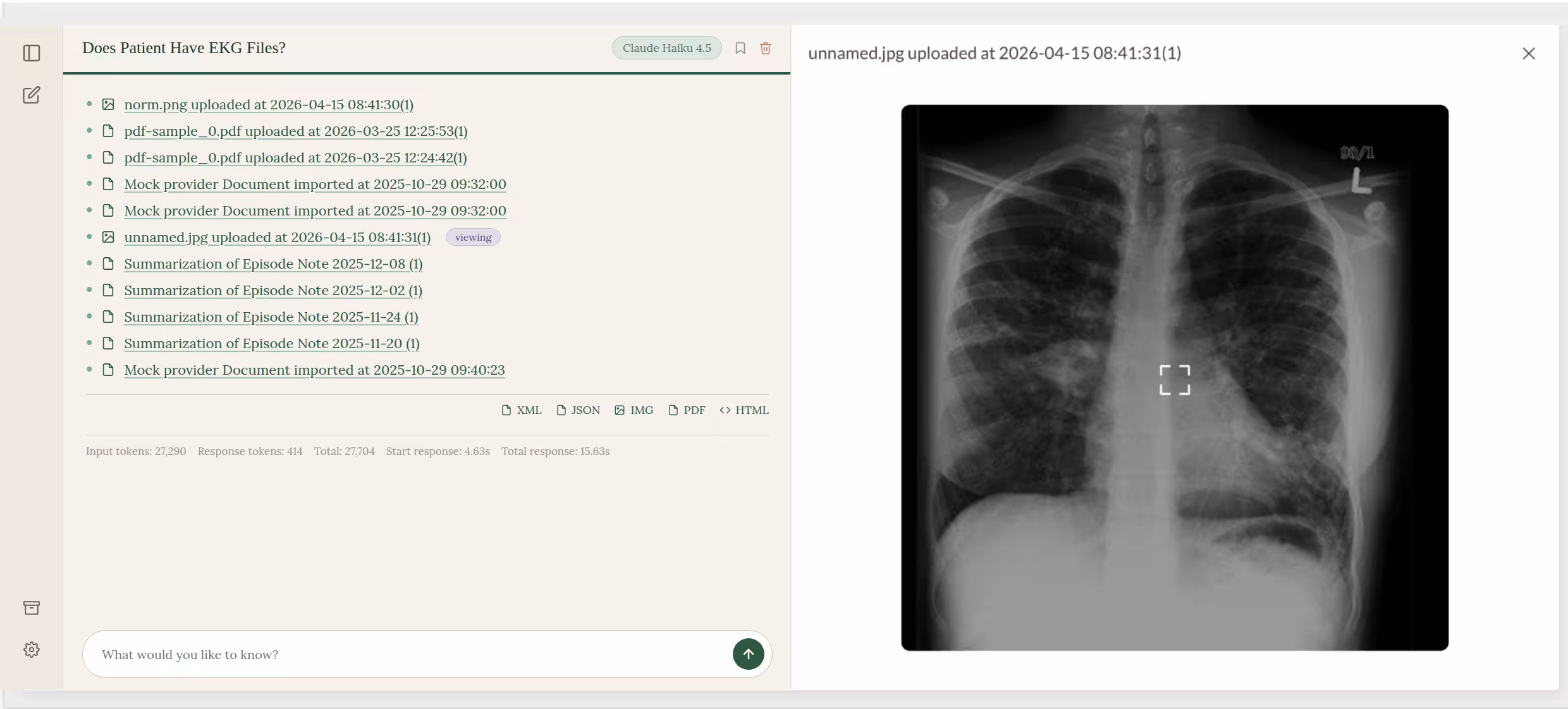 Preview panel showing an imaging file (ECG / X-ray) opened directly from an inline citation in the assistant's reply